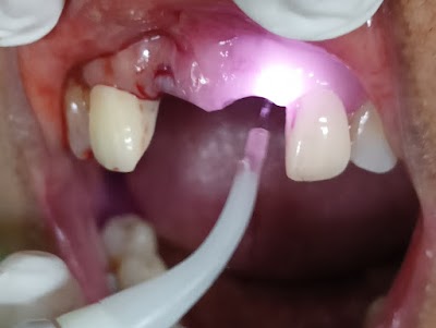 Irmalyn Marayag Tapitan Dental Clinic
