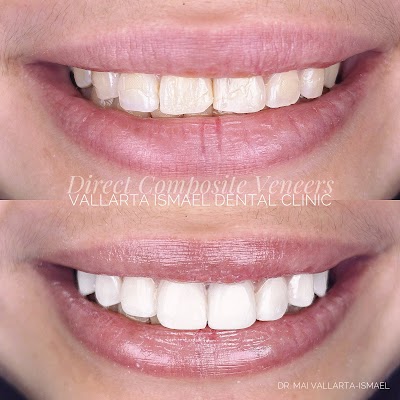 Vallarta-Ismael DENTAL CLINIC