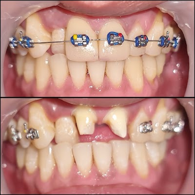 MY ARCHITEETH DENTAL CENTER GUIGUINTO INTO