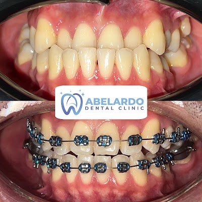 Abelardo Dental Clinic (Gapan 2nd Branch)